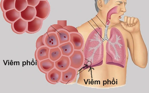 hạt bụi m 0 01g
